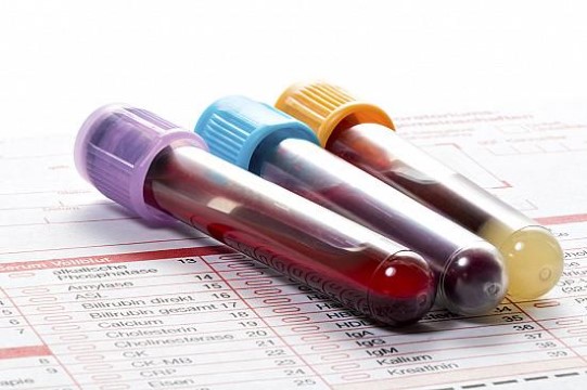 What to do when blood test results are not quite 'normal'